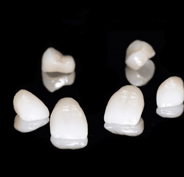 Porcelain Veneers