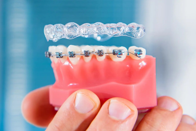 Orthodontics