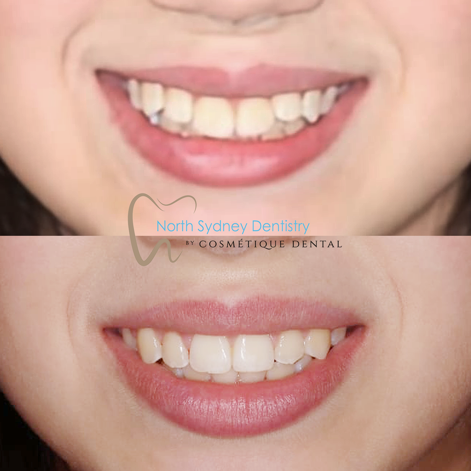 Orthodontics at North Sydney Dentistry
