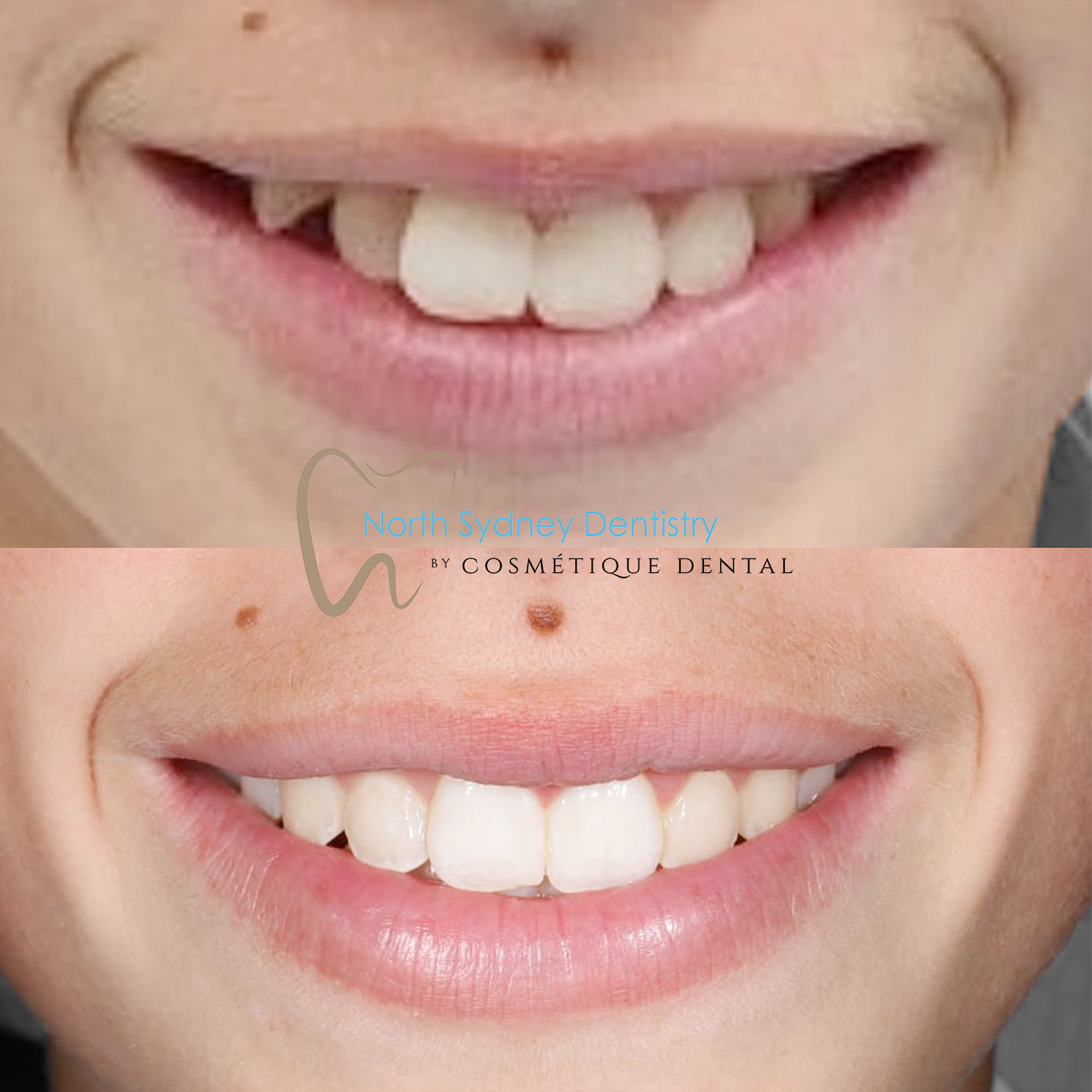 Orthodontics at North Sydney Dentistry