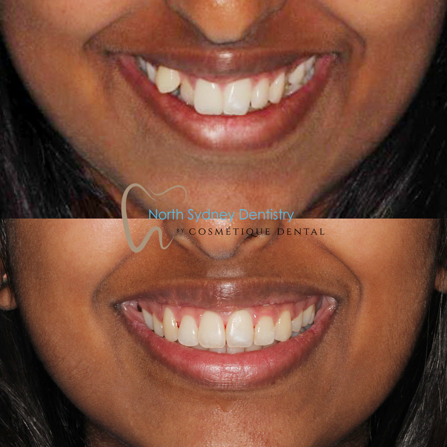 Orthodontics at North Sydney Dentistry
